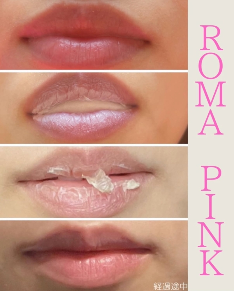 Roma Pink アフタークリーム リップ用 ピンク 3個セット ローマピンク