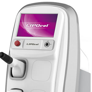 ライポソニック 痩身 機械 ボディ ダイエット サロン ライポソニック