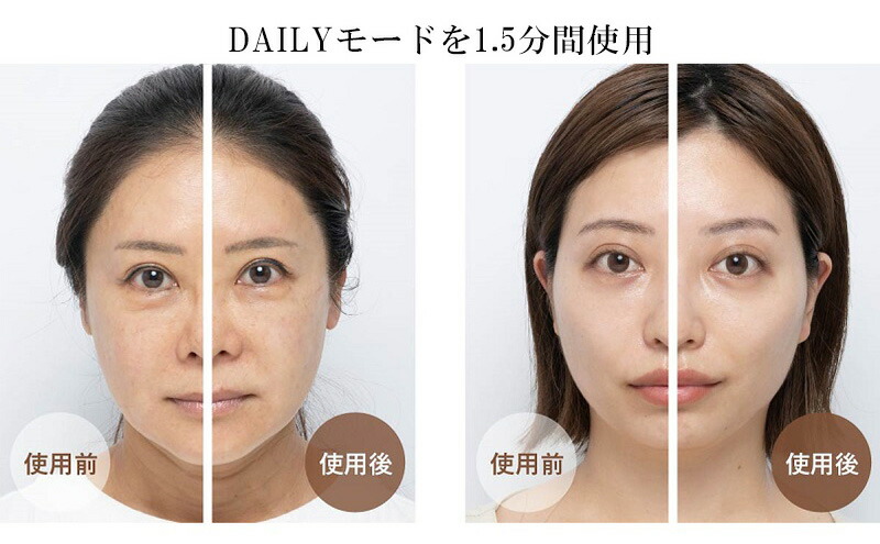 楽天市場】【ふるさと納税】美顔器 RF美顔器 フォトプラス シャイニー