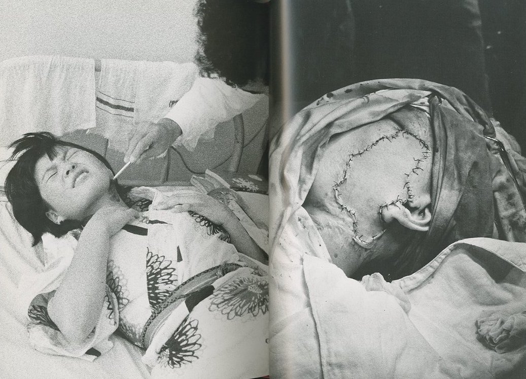 土門拳 ヒロシマ KEN DOMON HIROSHIMA 写真集