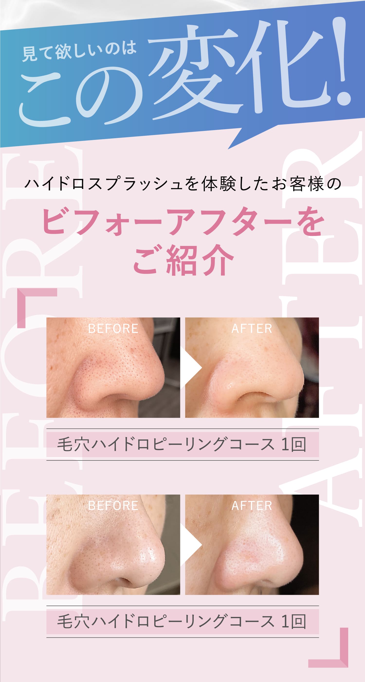 MISIRELTO ハイドロスプラッシュ