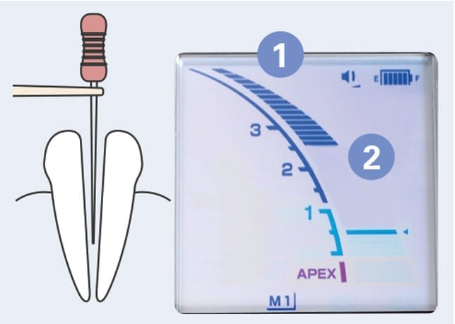 DentaPort ZX | MORITA