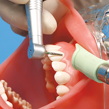 シンプルマネキンⅢ｜株式会社ニッシン｜歯科模型・歯科材料のトップ