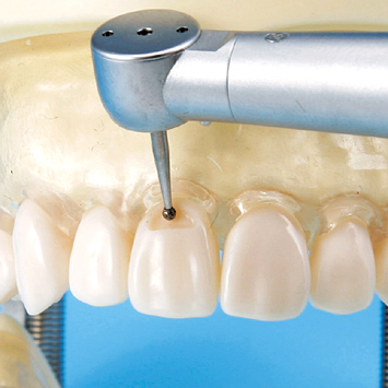 保存修復実習用顎模型 [D16FE-500E(GSD)](FE咬合器つき)｜株式会社