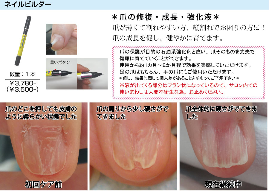 ペディグラス ニューパワーフリースタイル R10個 ペディグラス ニュー