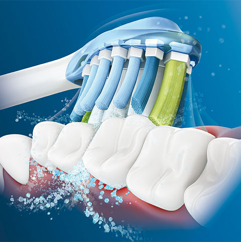 ソニッケアー史上最高*のブラッシング体験をあなたに「ソニッケアー