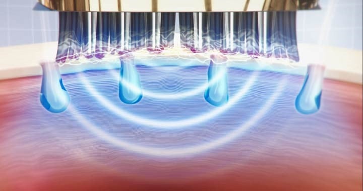 ヴェーダスカルプブラシ｜YA-MAN PROFESSIONAL (ヤーマン