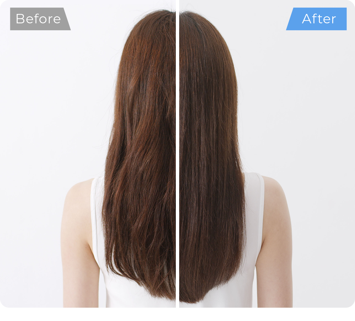 シャインプロ Shine Pro｜話題の超音波トリートメント｜ヤーマン