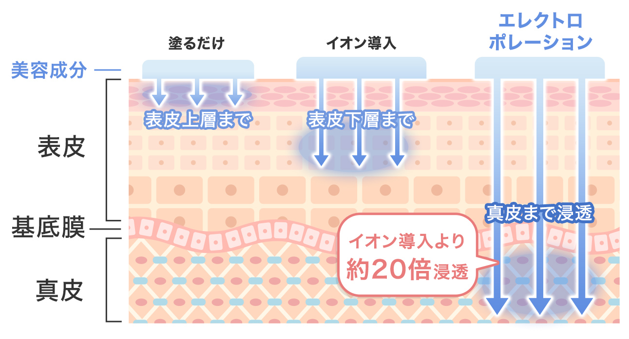 エレクトロポレーション | 美容整形クリニックA CLINIC【公式】