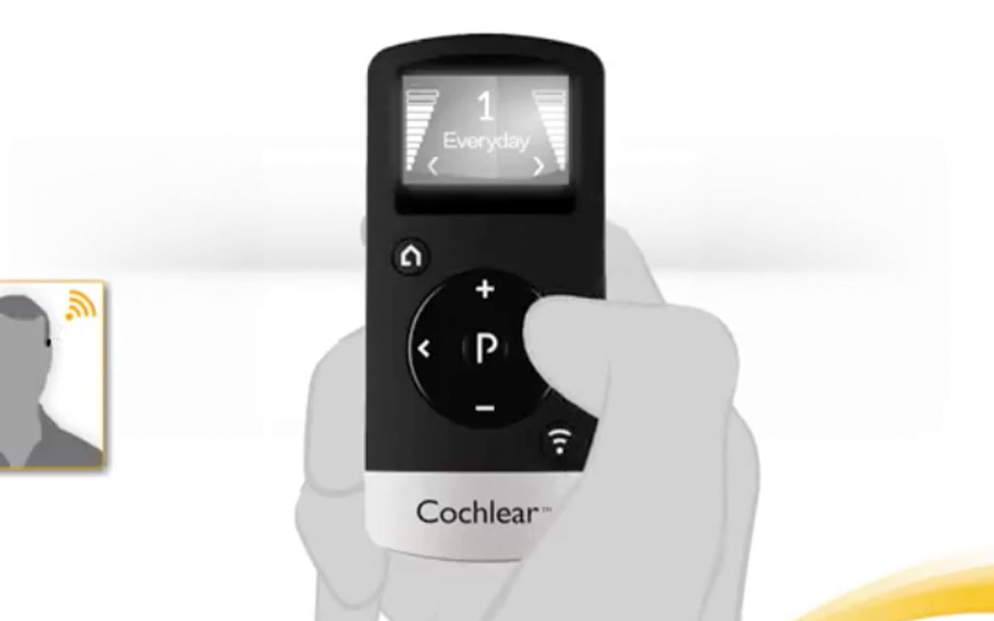 Baha® リモートコントロール取扱説明書