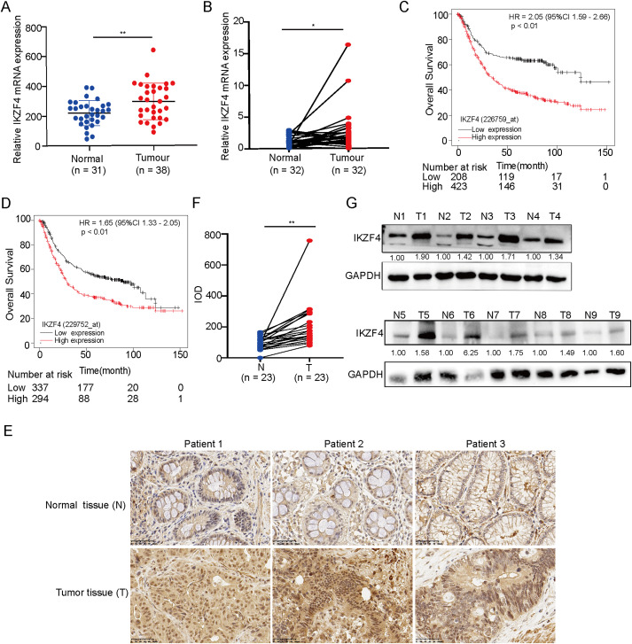 IKZF4/NONO-RAB11FIP3 axis promotes immune evasion in gastric