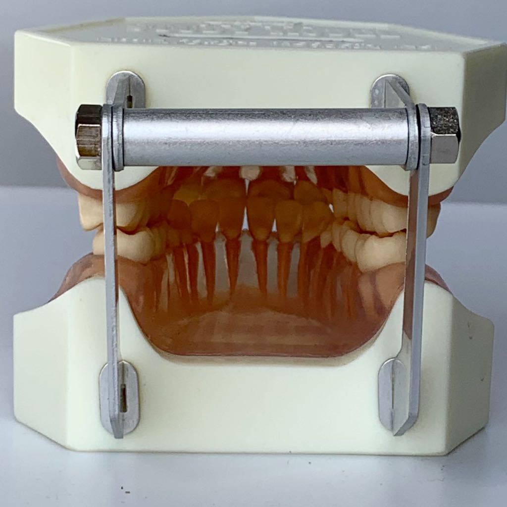 nissin 顎模型 がくもけい 歯牙模型 セット デンタルモデル 歯石セット