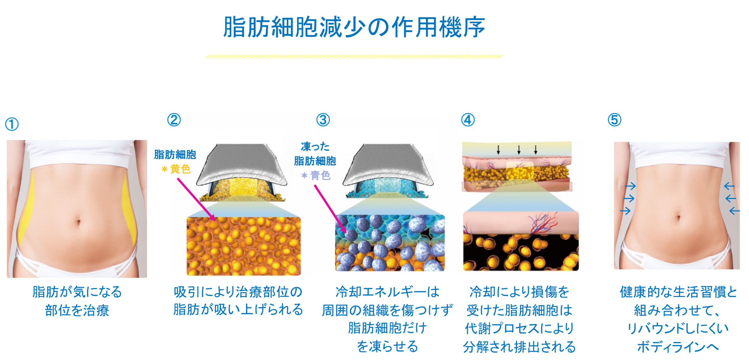 脂肪冷却クーリング2カップ