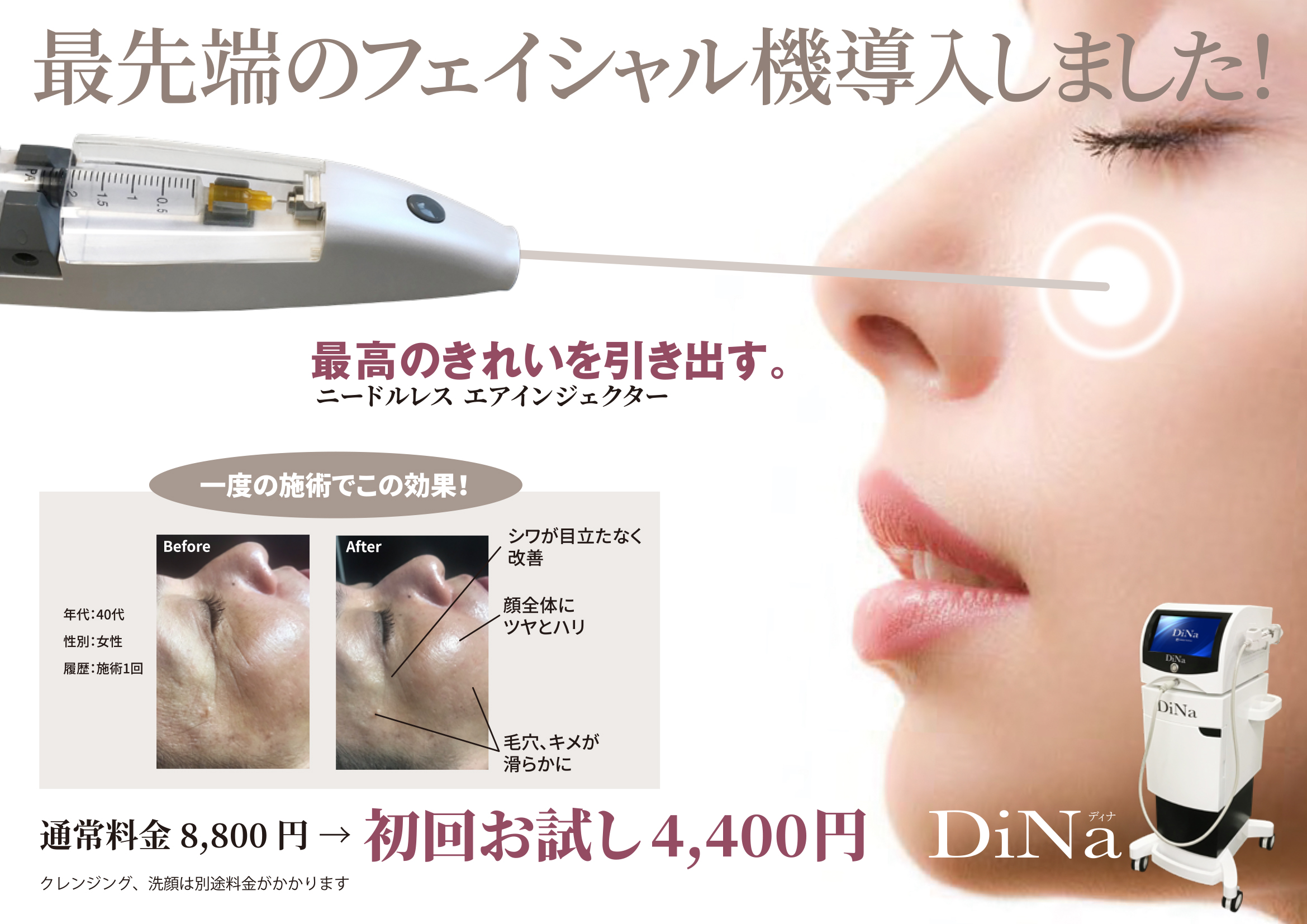 電動ノンニードル導入器/美容機器 /ポテンツァ美容/水光 ニードレス水