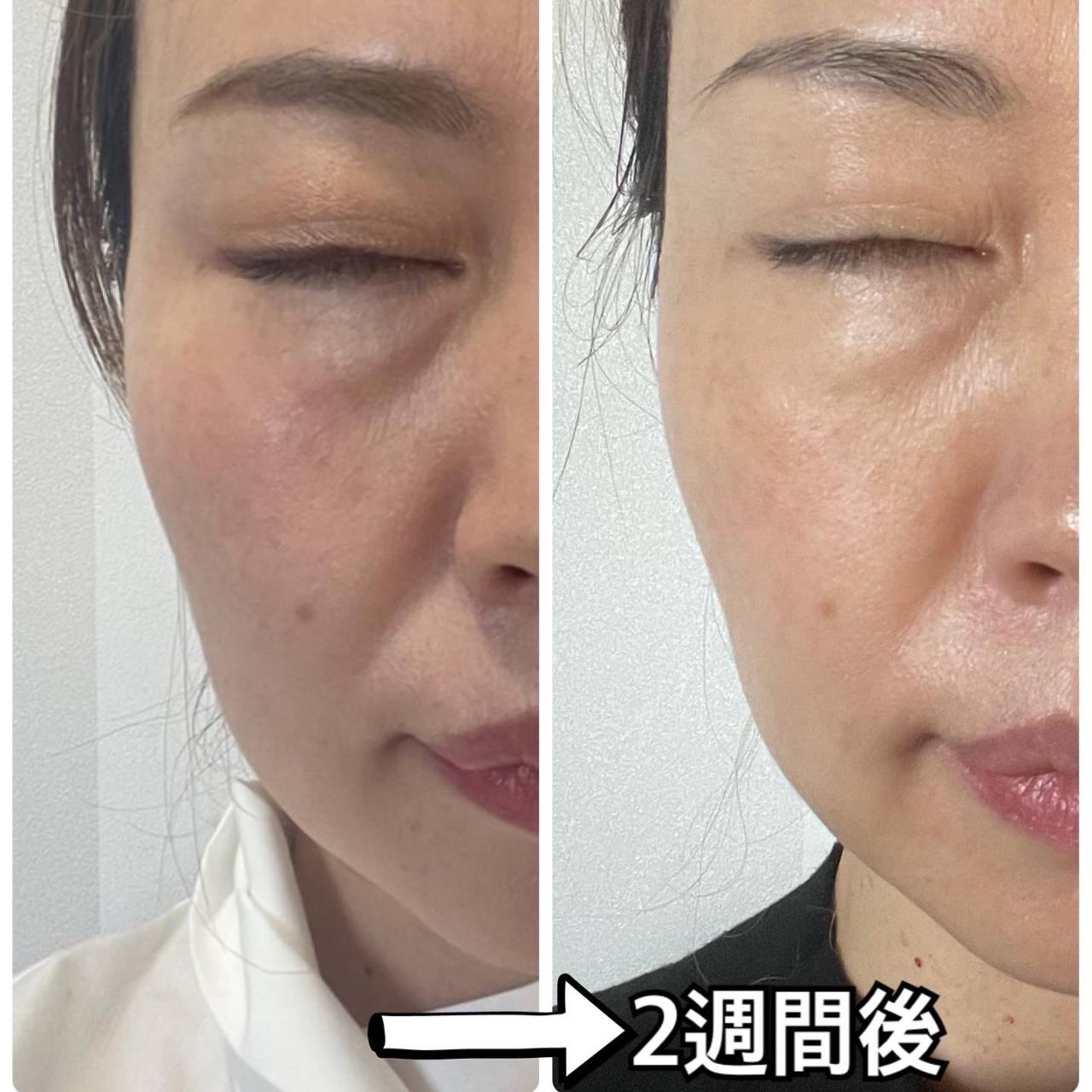 シックスパッドフェイシャルフィット シックスパット フェイシャル