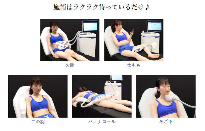 広島で脂肪冷却（クールスカルプティング）が安いクリニック6選