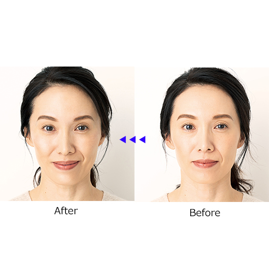 YA-MAN]メディリフト アイ | KOBUNSHA SELECT SHOP | [YA-MAN]メディ