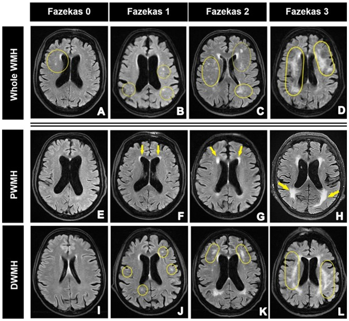 The role of magnetic resonance imaging in the diagnosis and