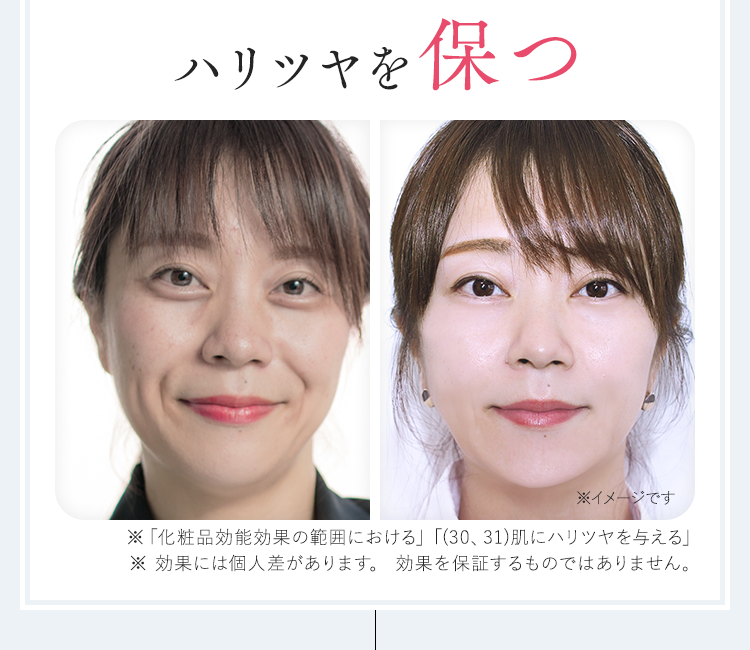 RF美顔器 導入プラス ボーテ・ヤヌス