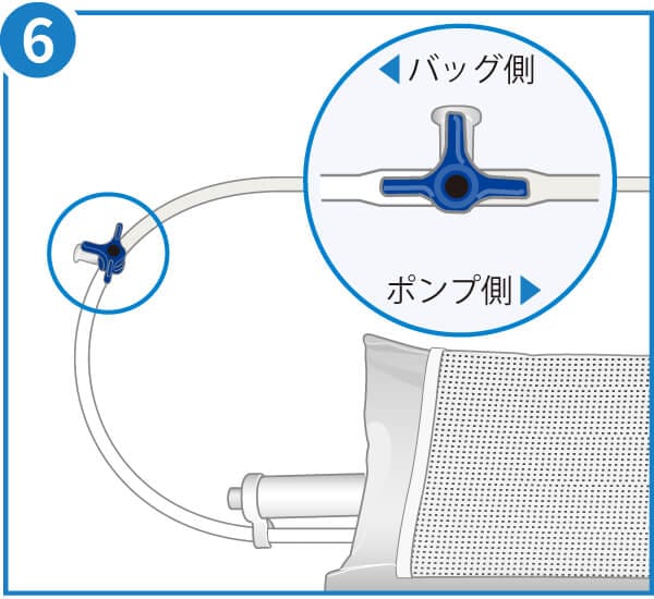 NIPRO EN加圧バッグCS 電動 EN加圧バッグ｜半固形状流動食関連｜医薬品