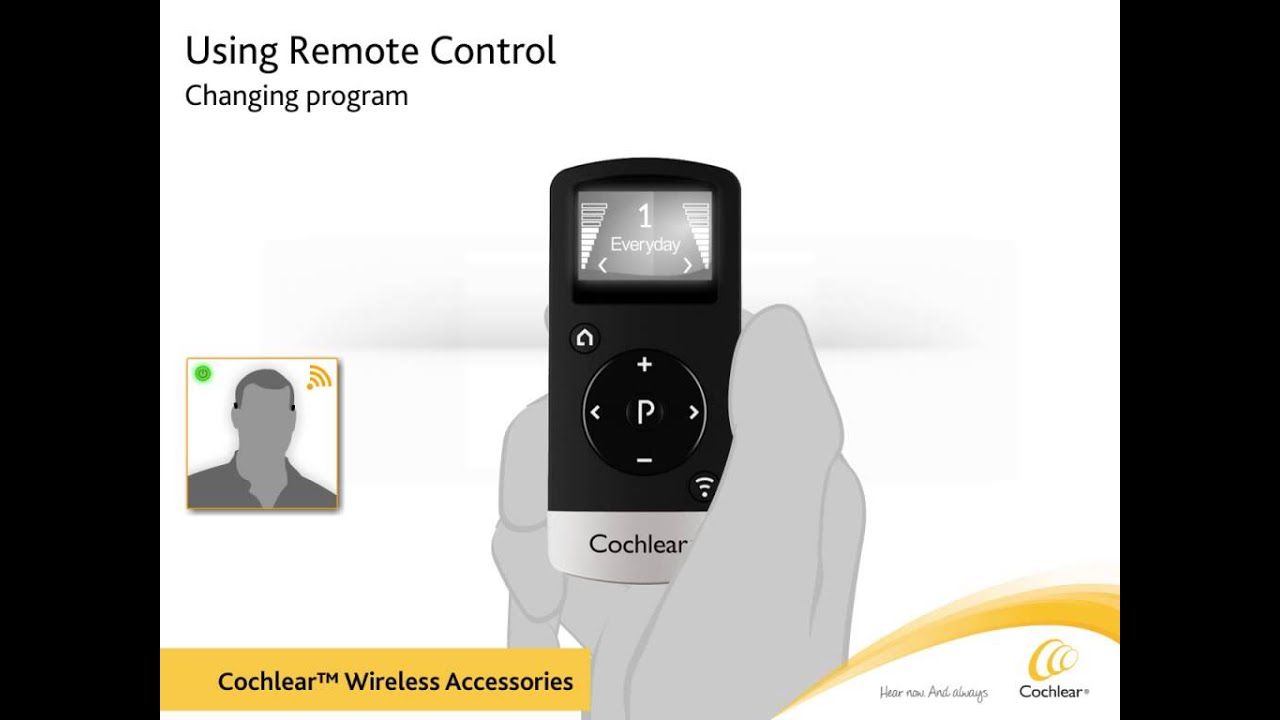 Baha® リモートコントロール取扱説明書