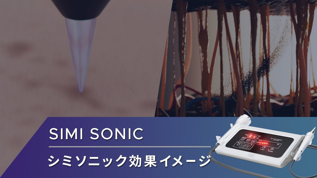 シミクライオポレーション | 株式会社Dr.Visea/ドクタービセア