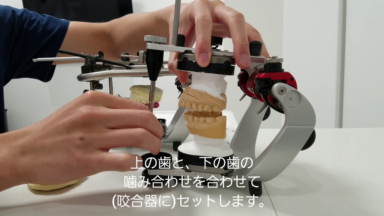 Face bow transfer, articulator attachment [Dental Atelier