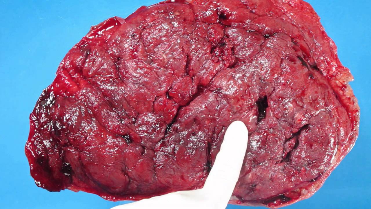 拙作「Placenta」 Axis Scientific Placenta Model with Removable