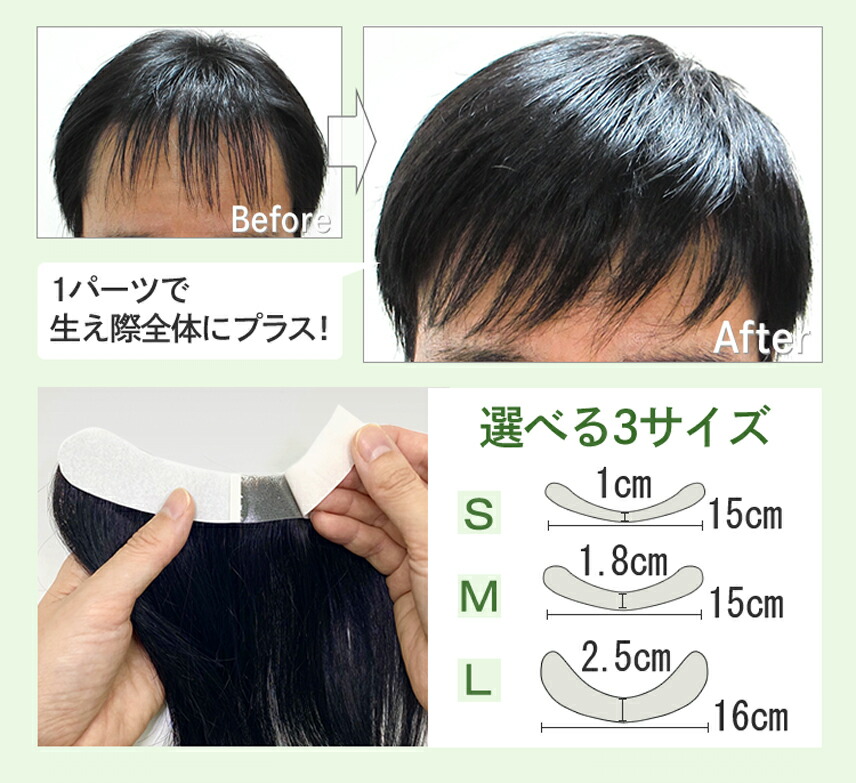 楽天市場】生え際全体にプラス！増毛くんシリーズはえぎわくん【L