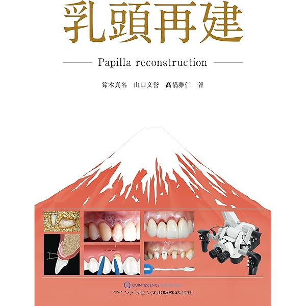 ボンディッドポーセレンレストレイションズ: バイオミメティック