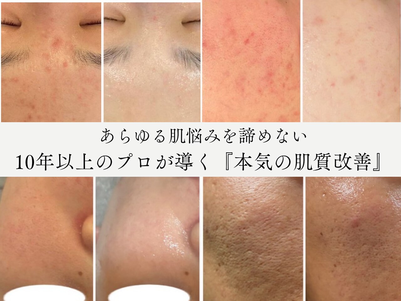 ボディ・フェイスケア NOA ノア 新宿(Noa)｜ホットペッパービューティー