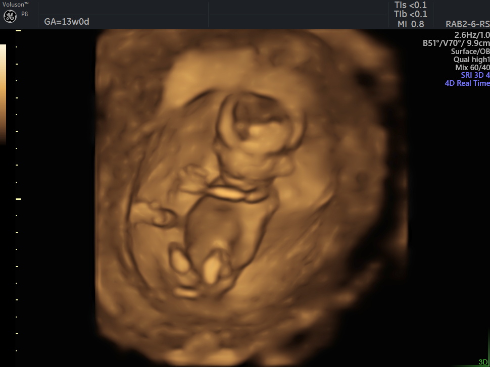 4Dエコーについて | かなこレディースクリニック横浜みなとみらい 横浜