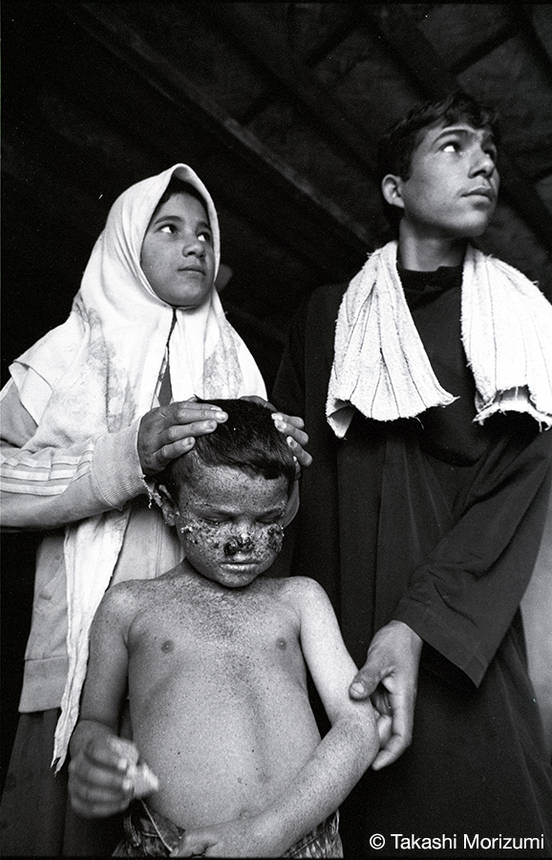 2003年イラク戦争 戦時中 子供 写真 湾岸戦争の子どもたち IRAQ1998
