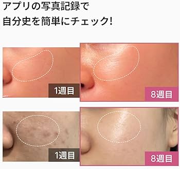 Amazon.co.jp: メディキューブ AGE-Rブースタープロ ピンク 1日5分韓国