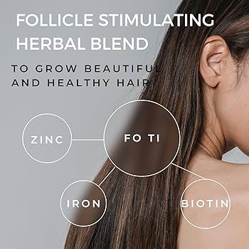 Amazon.com : Ebony Medical Hair Support Supplement for Women of