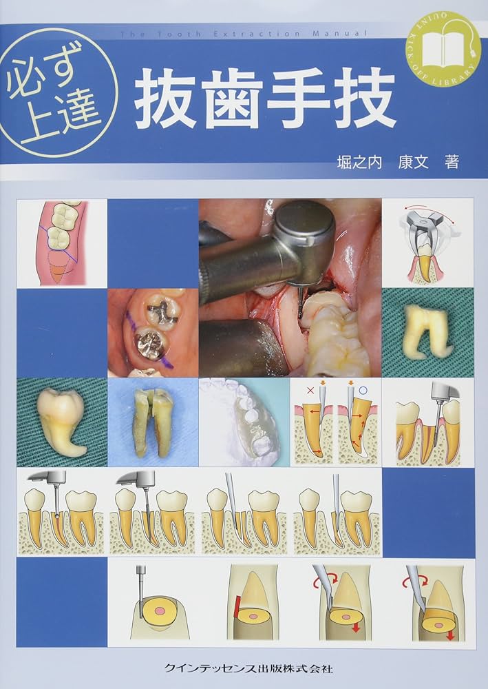 必ず上達 抜歯手技 増補新版 裁断済み 必ず上達 抜歯手技 | 堀之内 康文 |