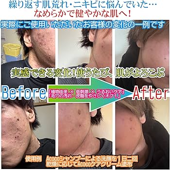 Amazon.co.jp: 【ACOCO® 公式】シャンプー & ケアクリーム セット