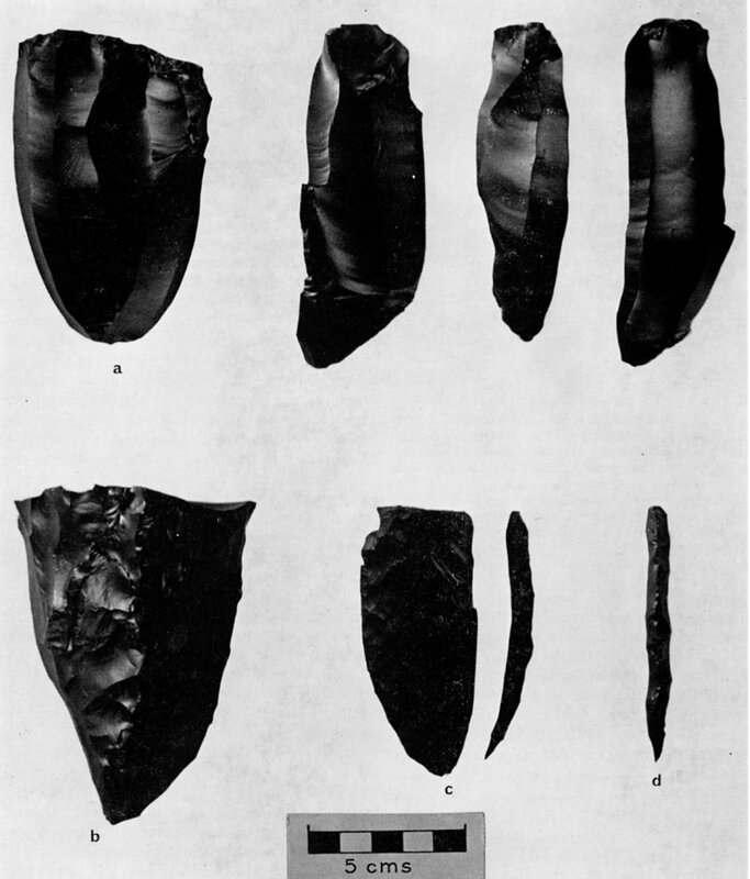 縄文人は「黒曜石」で外科手術をしていた？（石田雅彦