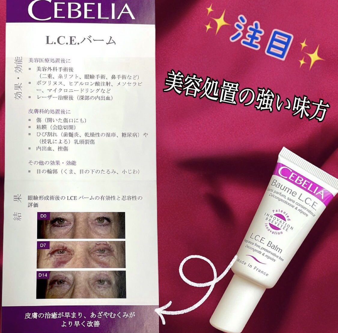 セベリア 2点セット