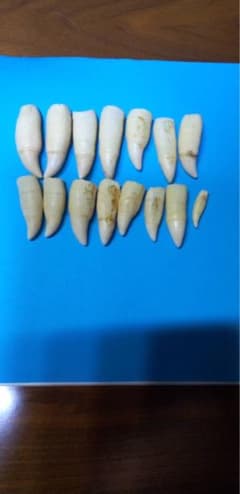 k*l様 ⭐︎激レア⭐︎希少⭐︎シャチの歯 骨董品 - メルカリ