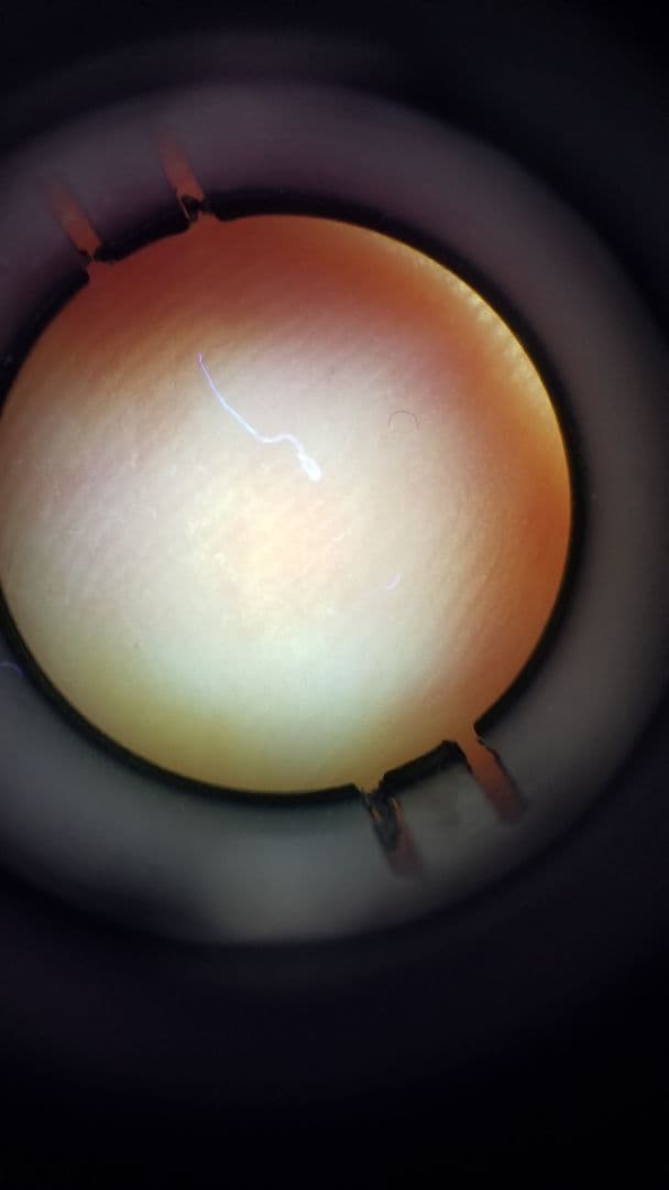 ダーモスコープ(DermLite Uva) ダームライトの通販｜endoscopyonair.com