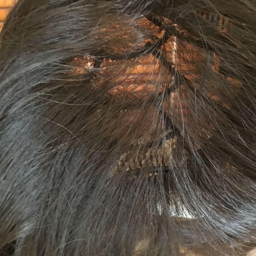 ぼむぼむ。 新品未使用　レオンカ トップピース　SF-T78.