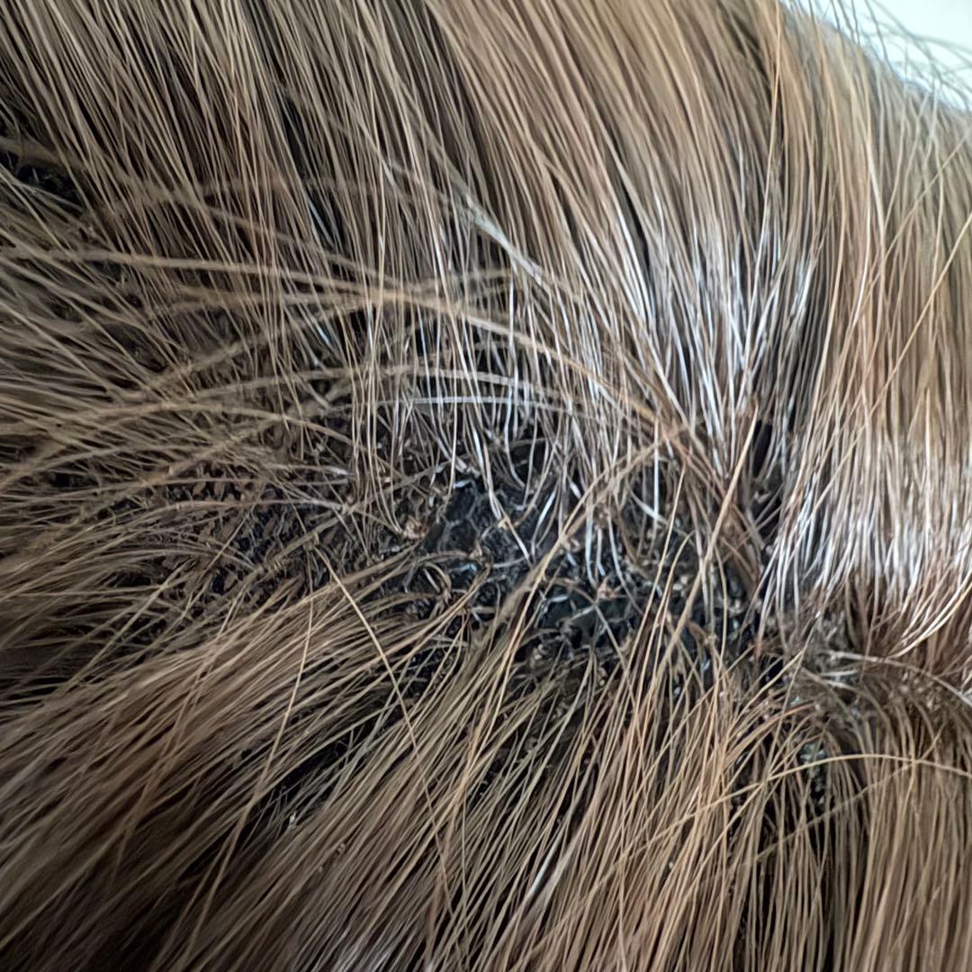 医療用ウィッグ