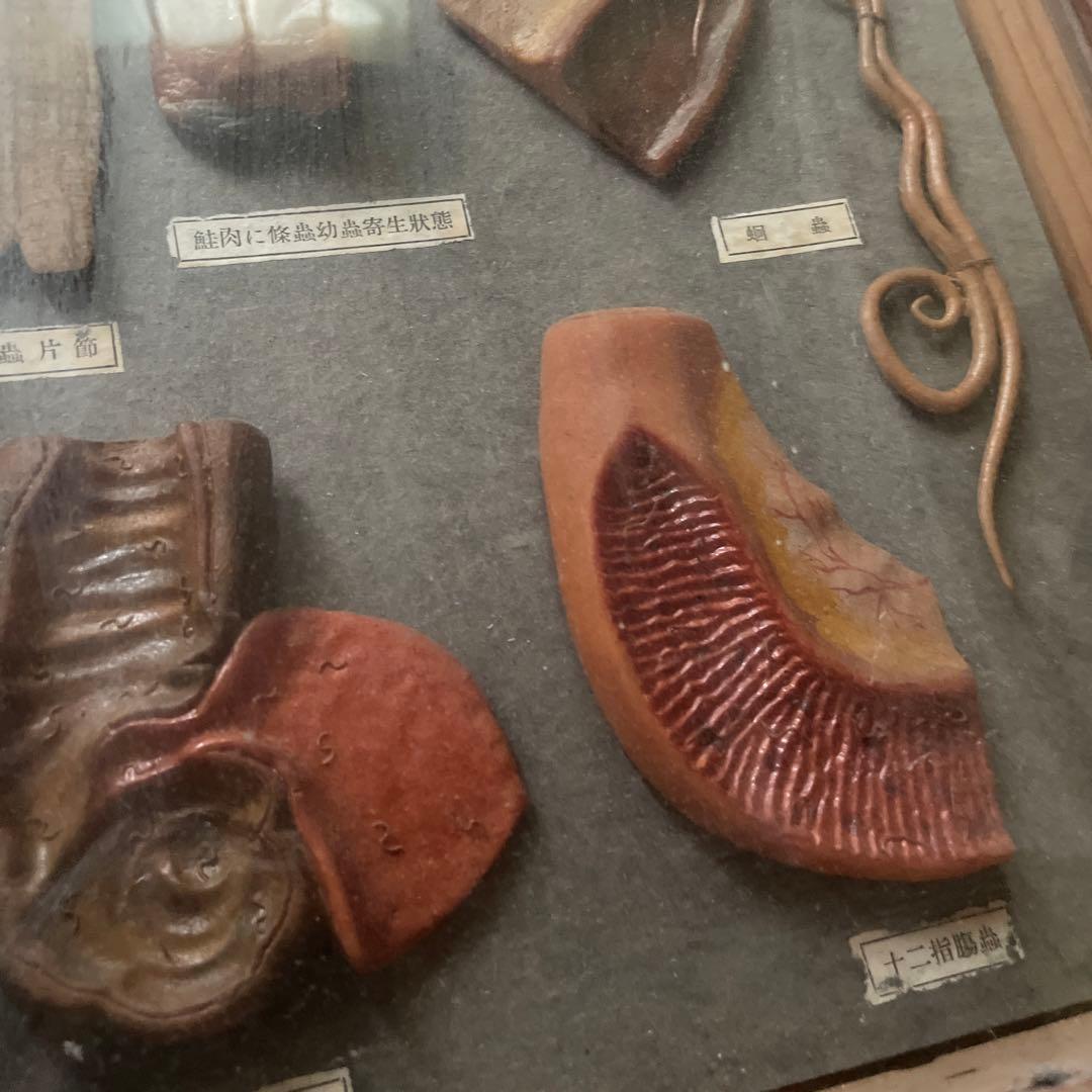 珍品、レトロ 医学模型 寄生虫