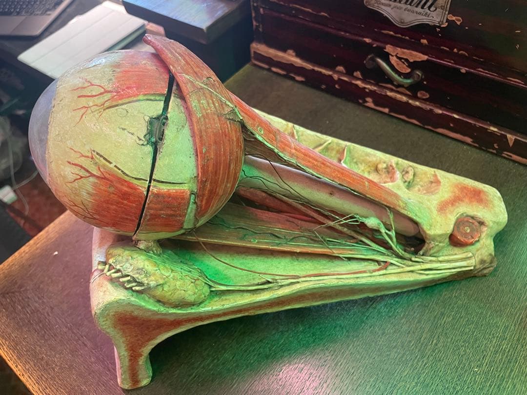 眼球医療用模型