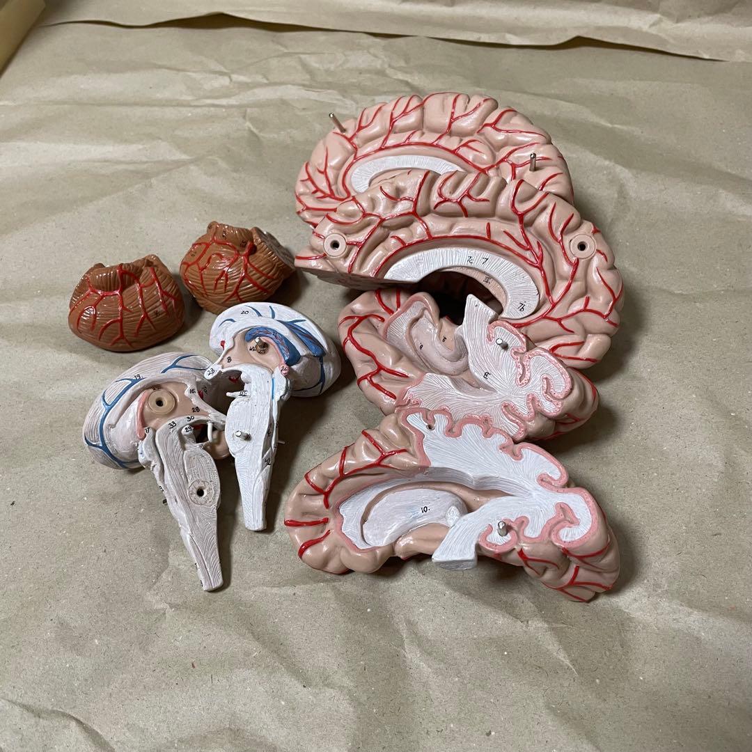 脳模型 医学 3B 9分解モデル ドイツ製