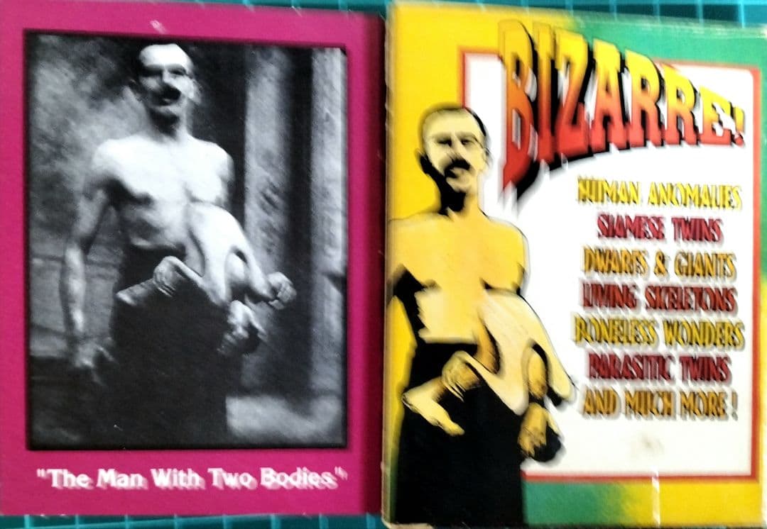 フリークスカード 畸形 見世物小屋 異端 米国製 『希少品』 - メルカリ