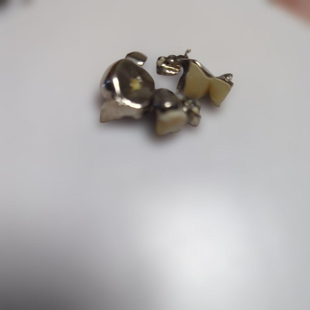 m*o様 銀歯/被せ物