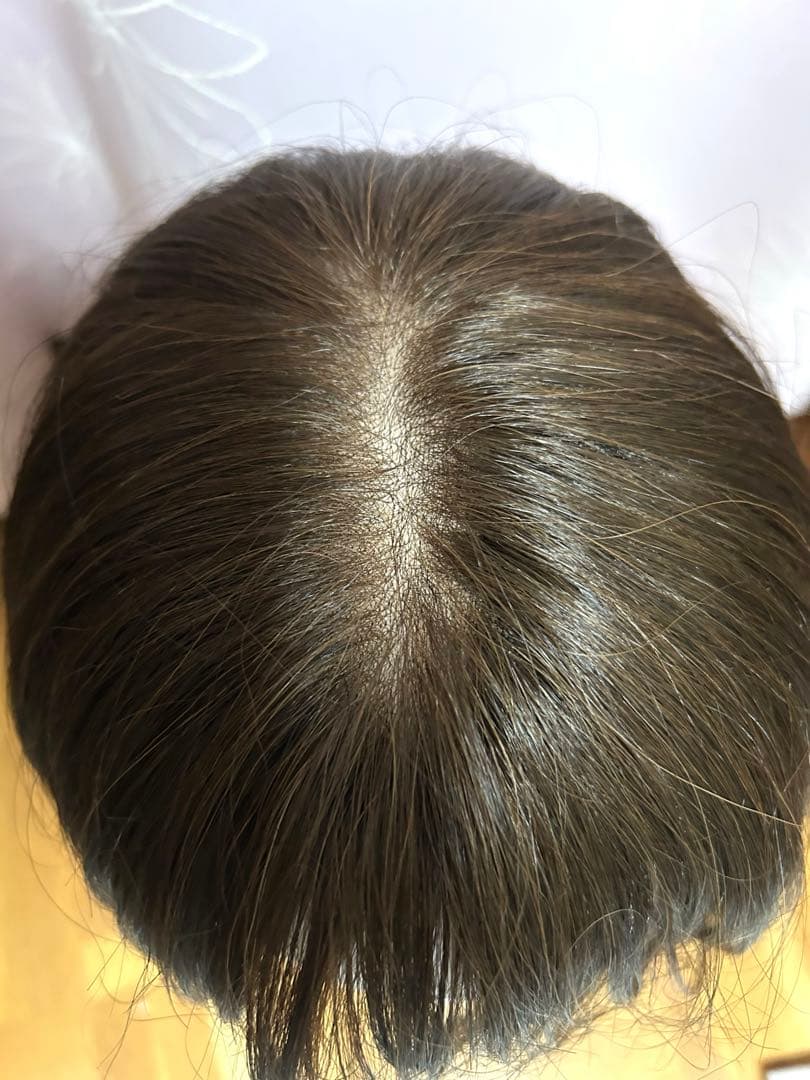 スヴェンソン　医療用ウィッグ