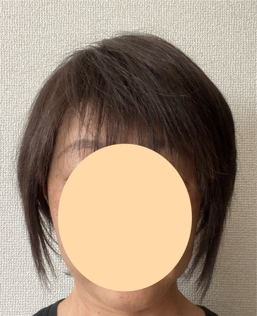 アデランス FONTAINE 医療用ウィッグ FO4 F4人毛+合成繊維